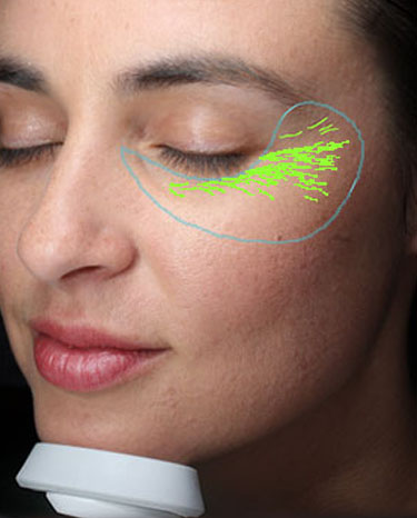 3D Facial Wrinkle Analysis